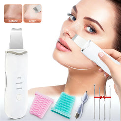 Electric Ultrasonic Skin Scrubber – Deep Cleansing & Blackhead Remover