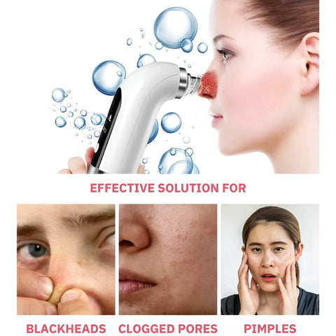 Hydrodermabrasion Blackhead Remover And Vacuum Pore Cleaner - onlinemegasale.com