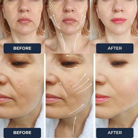 Skin Facial and Neck Muscle Rejuvenation Beauty Massager - onlinemegasale.com