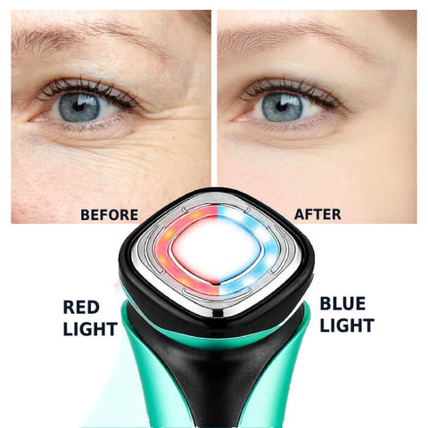 Vibrating Facial Massager With Red Light Therapy - onlinemegasale.com