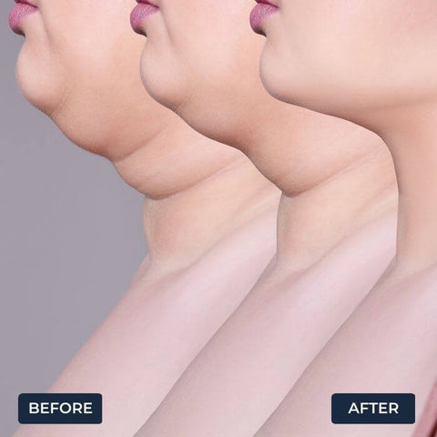 Neck Massager for Anti Wrinkles and Fine Lines - onlinemegasale.com
