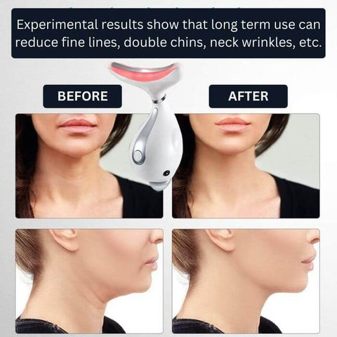 Skin-Tightening & Lifting Massager for Face and Neck - onlinemegasale.com