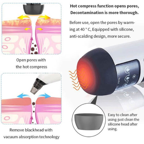 Pore Vacuum Blackhead and Whitehead Remover for Nose and Face - onlinemegasale.com