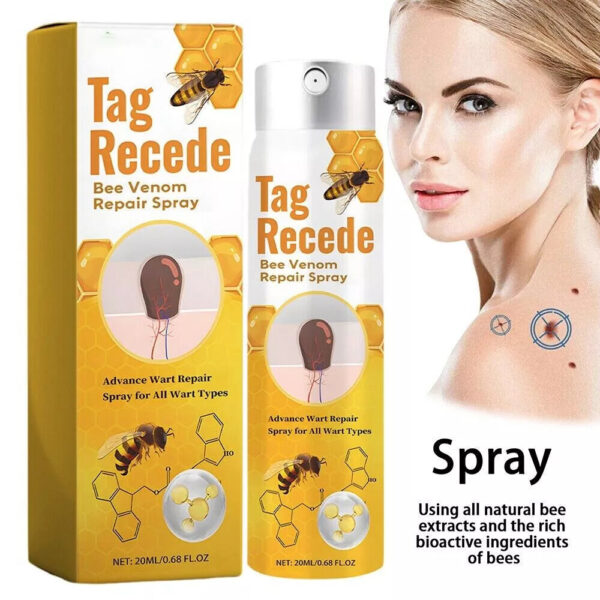 Non-Invasive Tag Recede