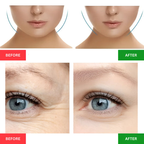 Microcurrent Facial Device Roller for Wrinkles - onlinemegasale.com