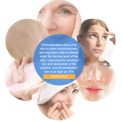 Portable Cool & Hot EMS For Skin Tightening - onlinemegasale.com