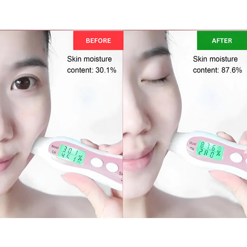 Nano Mist Facial Steamer - onlinemegasale.com