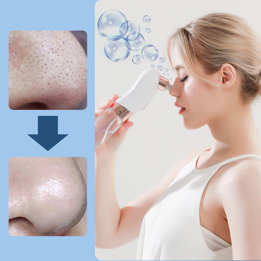 STYLPRO Hydro Exfoliator - onlinemegasale.com