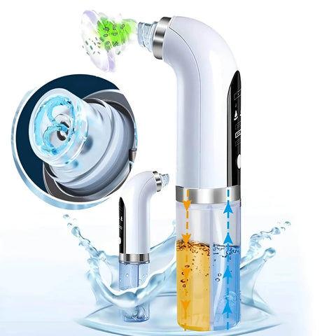 Hydrodermabrasion Blackhead Remover And Vacuum Pore Cleaner - onlinemegasale.com