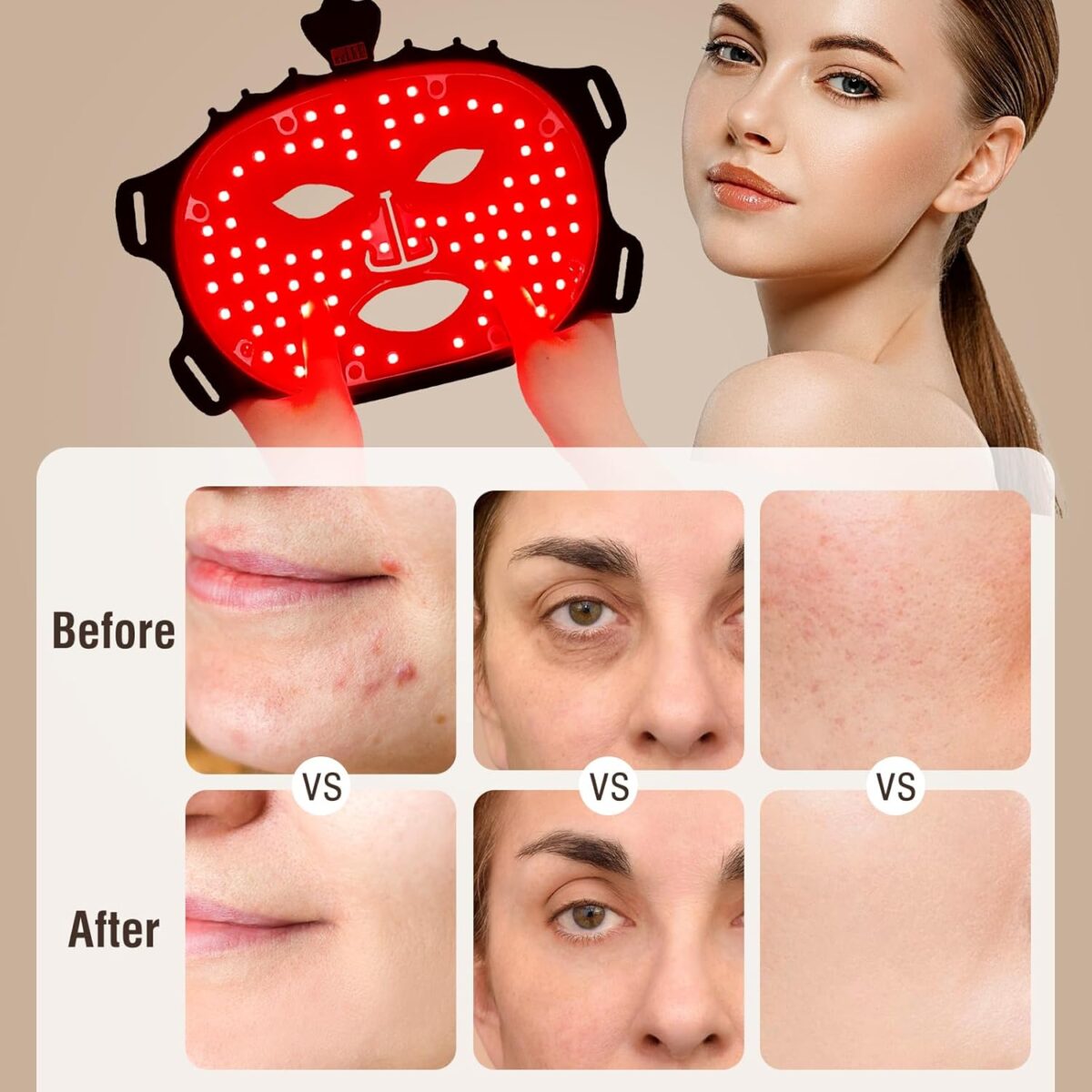 Face Mask Light Therapy Gen.2 - onlinemegasale.com