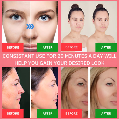 MystMist Facial Steamer and Hydrator - onlinemegasale.com