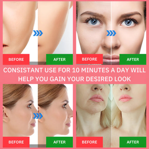 LED Light Therapy Machine for Skin Rejuvination - onlinemegasale.com