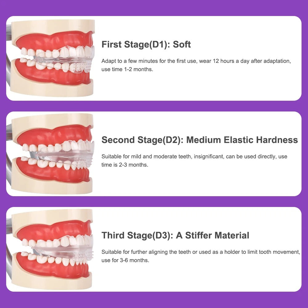 Dental Aligner Braces- Orthodontic Teeth Alignment Brace Trainer - onlinemegasale.com Dental Aligner Braces- Orthodontic Teeth Alignment Brace Trainer - onlinemegasale.com