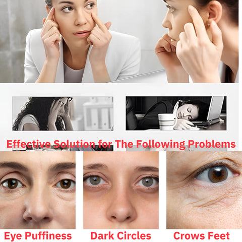 Eyelid Massager Pen with Sonic Vibration for Crows Feet and Eye Bags - onlinemegasale.com