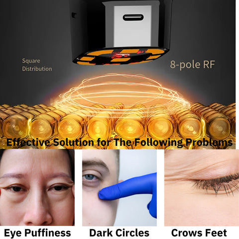 Facial RF Skin Tightening Device Combats Signs Of Aging - onlinemegasale.com
