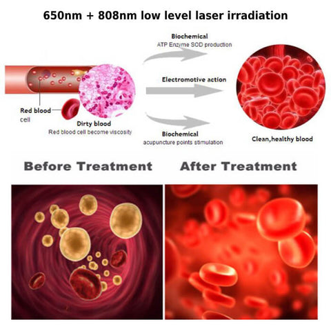 LLLT Cold Level Laser Therapy for Joint Pain - onlinemegasale.com
