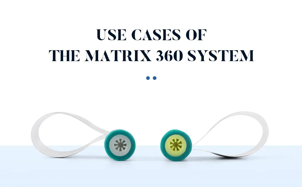 50 Pcs/Box BAISTRA Dental Matrix Bands Steel Matrix Double-Side Contoured Anatomically Shaped Matrix Bands For Dentistry - onlinemegasale.com