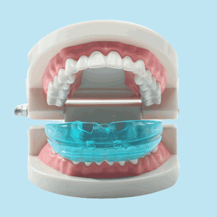 Dental Aligner - Orthodontic Teeth Alignment Brace Trainer - onlinemegasale.com How Much Do Clear Braces Cost