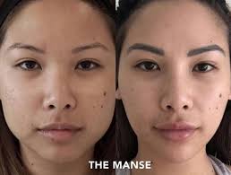 Slimming Face Lift Band - onlinemegasale.com