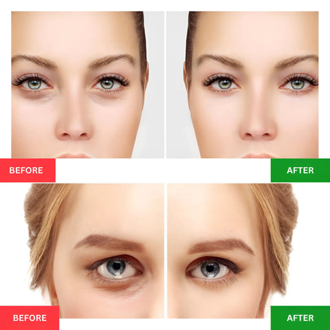 Dark Circle Removal, Hot Compress Eye Massager For Skin Rejuvenation - onlinemegasale.com
