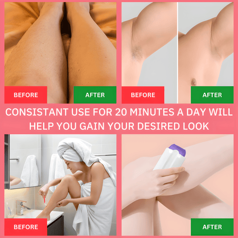 Lumishave Painless Hair Removal Silky Smooth Epilator - onlinemegasale.com