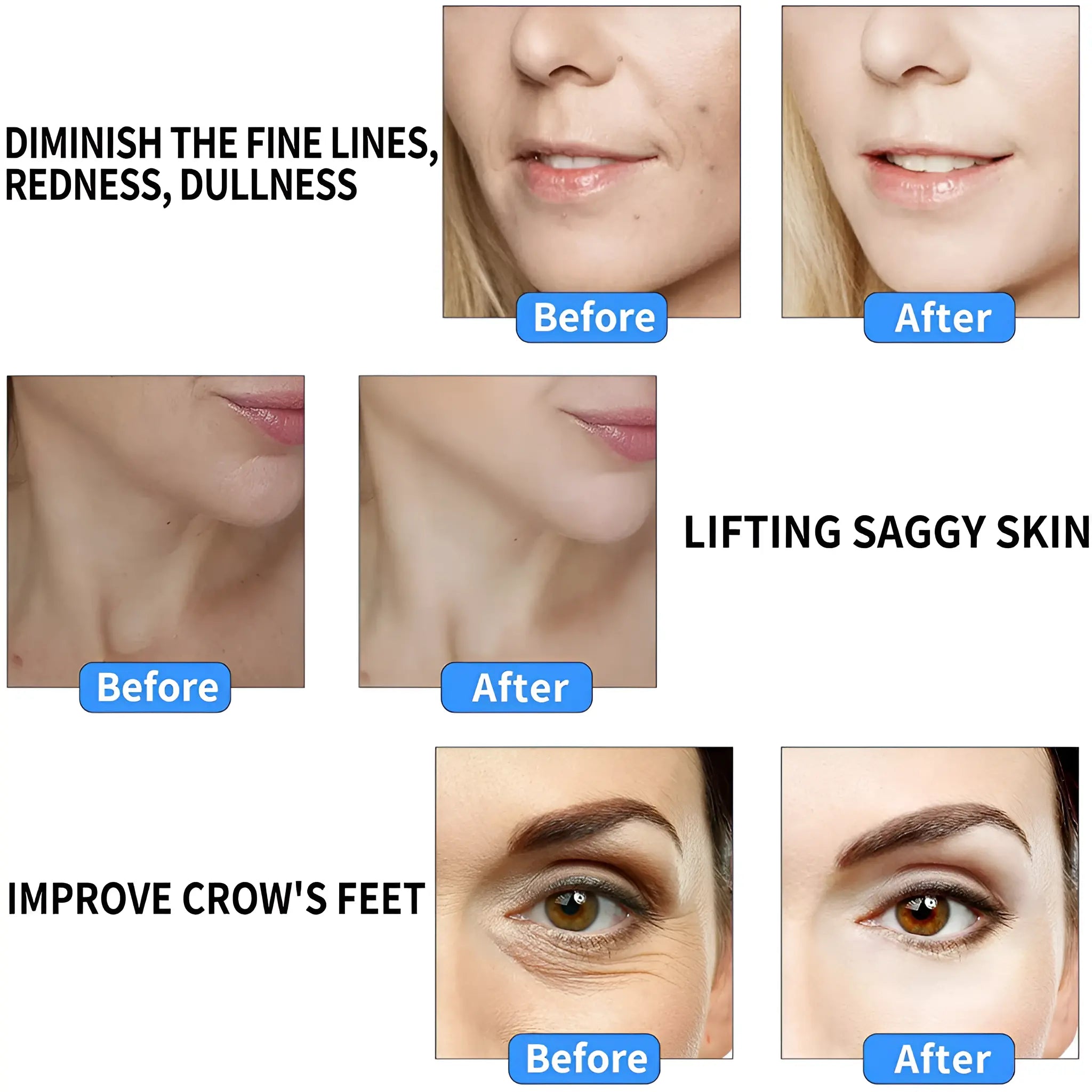 Facial Massager - EMS RF Beauty Instrument - Face Lifting Machine - Sonic Vibration Machine - onlinemegasale.com