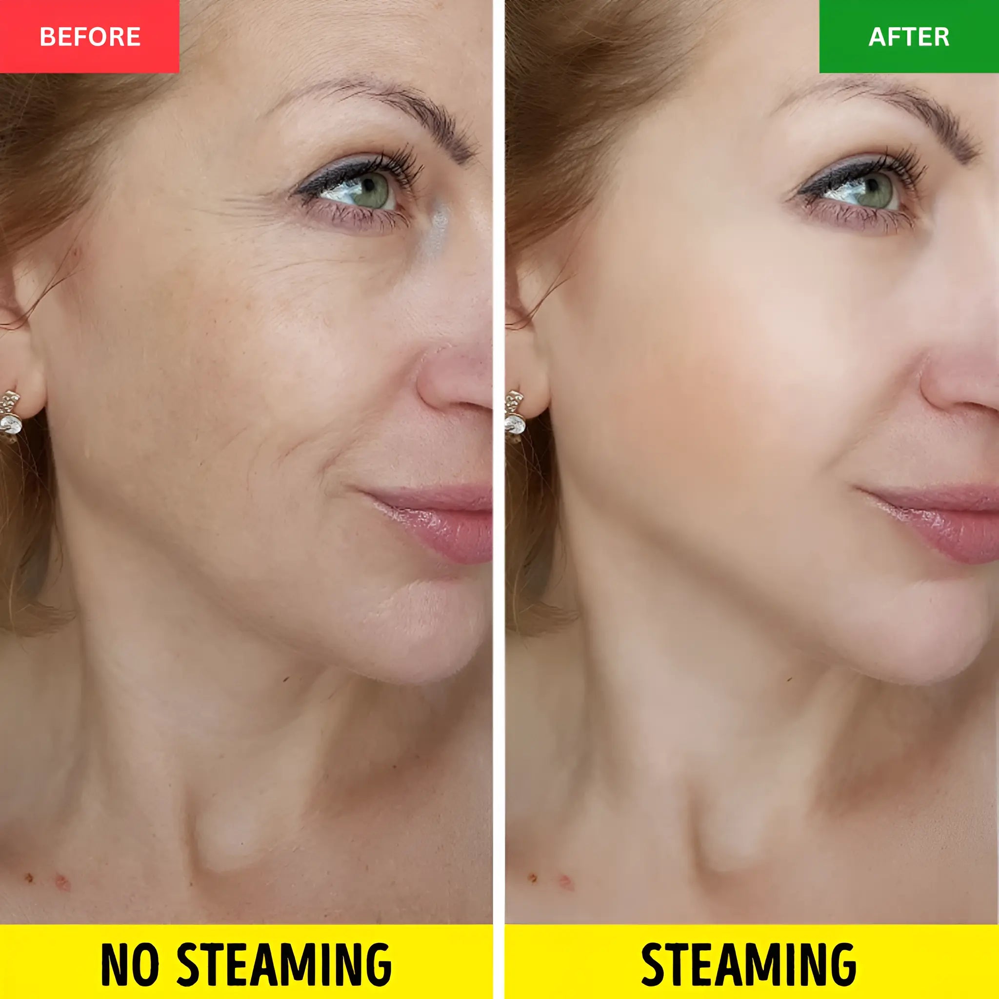 Facial Oxygen Therapy - Skin Care Sprayer - onlinemegasale.com