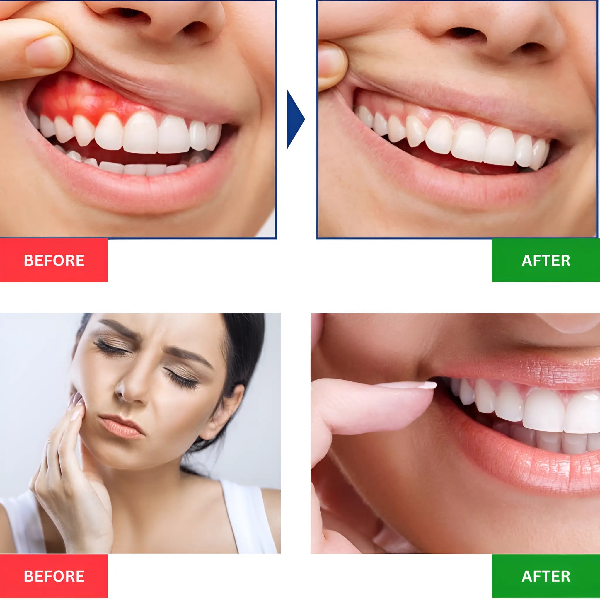 Oral Red Light Therapy for Gums, Toothache Relief - onlinemegasale.com