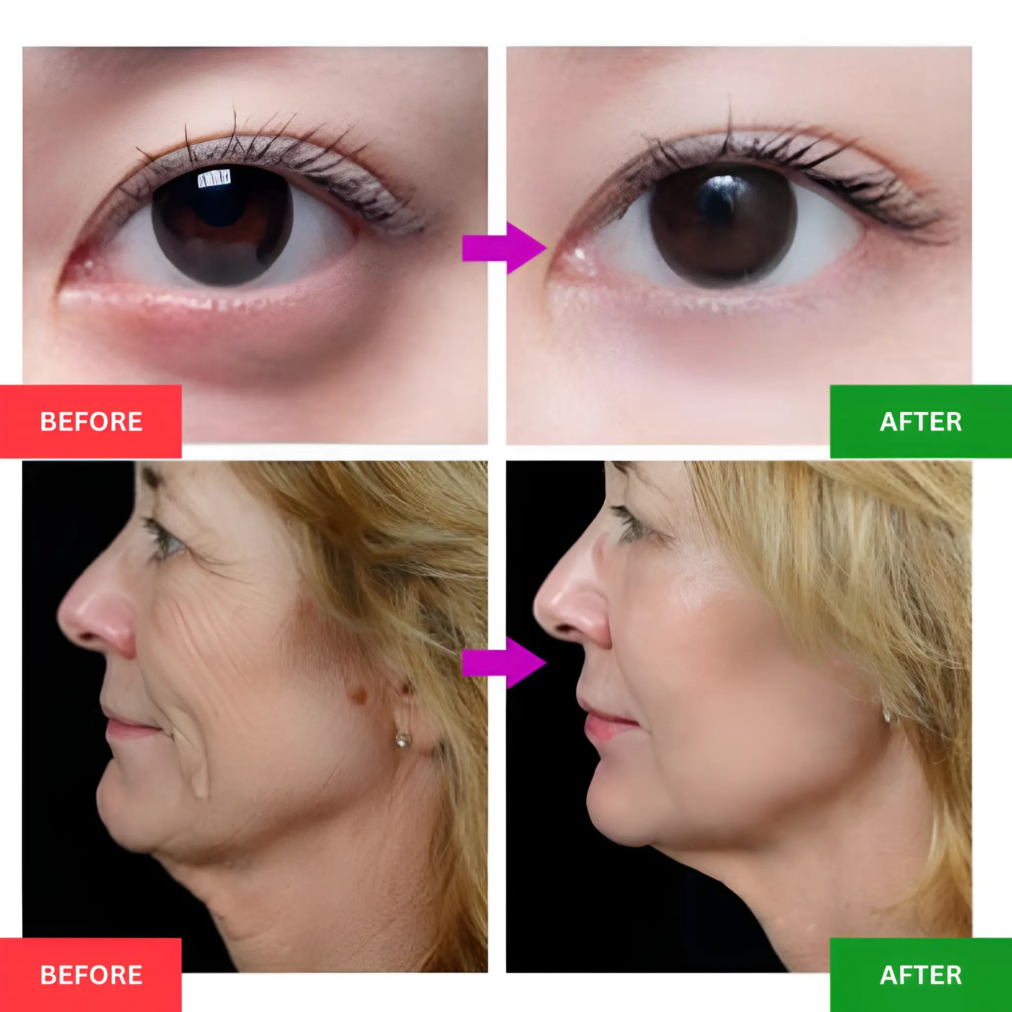Eye Bag Removal EMS Facial Device - onlinemegasale.com