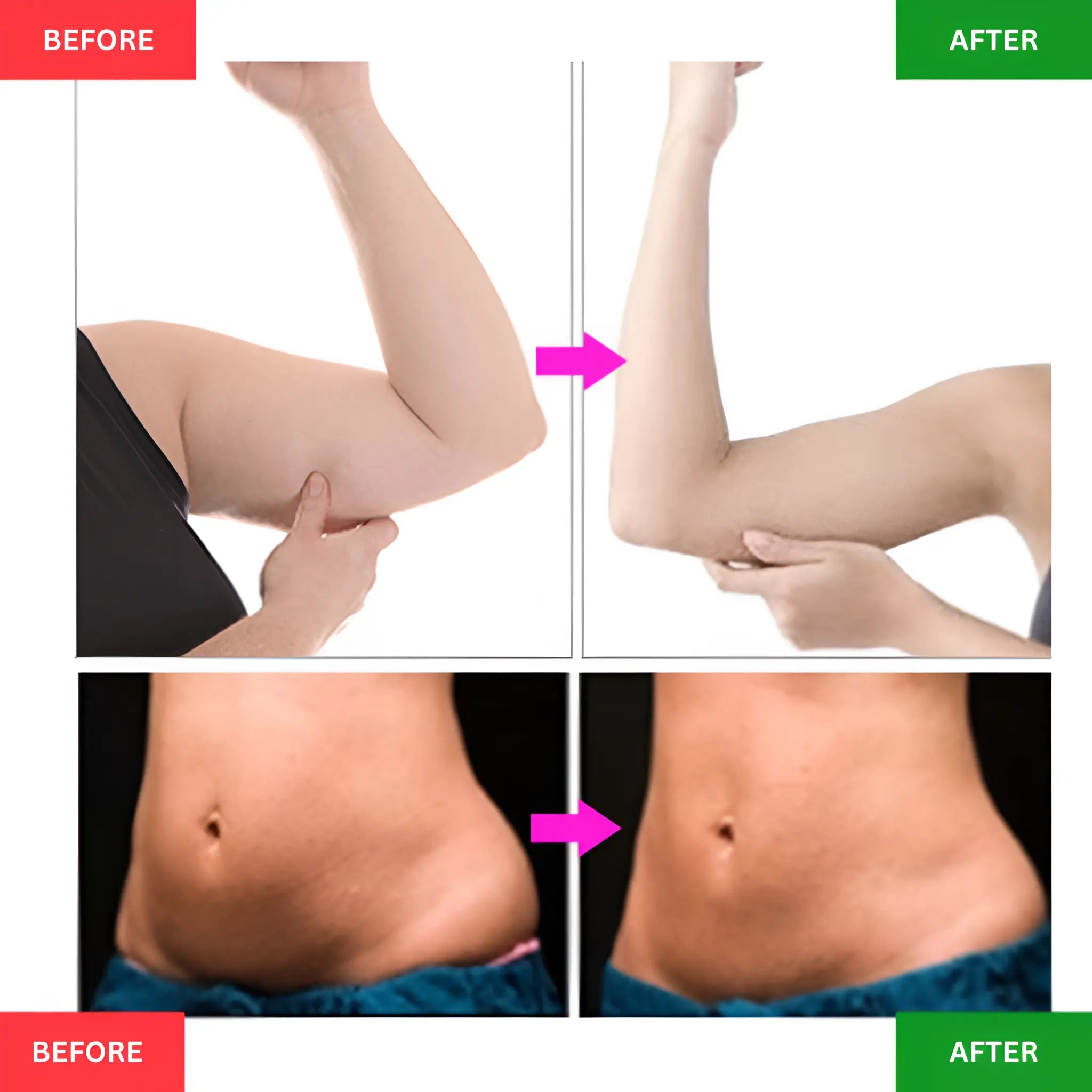 Ultrasonic Cavitation Device For Slimming and Fat Reduction - onlinemegasale.com