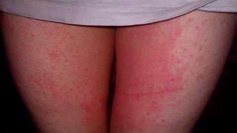 Mother's Day Pre-sale 48% 0ff - Anti-chafing Active Skort - Buy 3 Free Shipping Now! - onlinemegasale.com