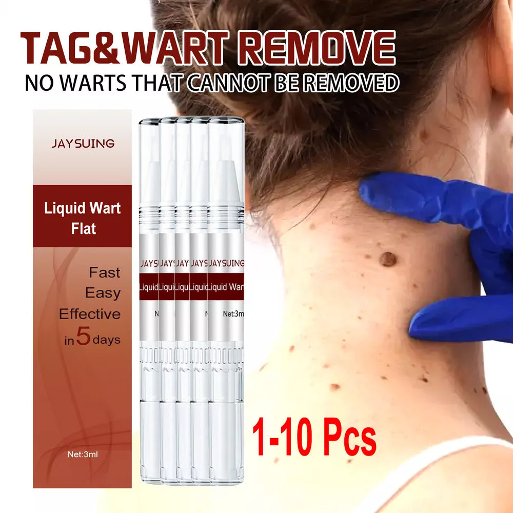 Tags & Moles Remover – Quick & Scar-Free Solution for Skin Tags & Warts - onlinemegasale.com