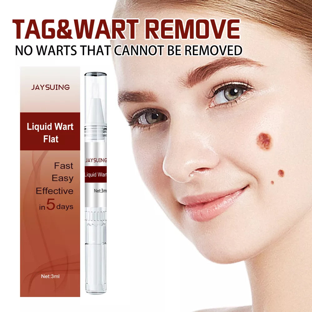 Tags & Moles Remover – Quick & Scar-Free Solution for Skin Tags & Warts - onlinemegasale.com