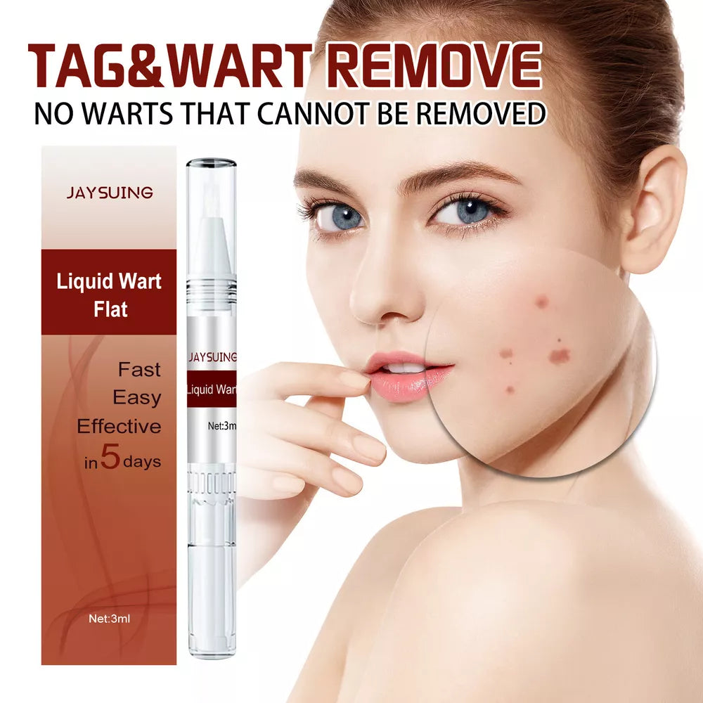 Tags & Moles Remover – Quick & Scar-Free Solution for Skin Tags & Warts - onlinemegasale.com