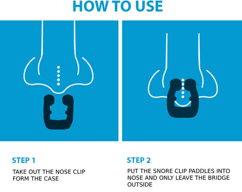How to use anti snoring device