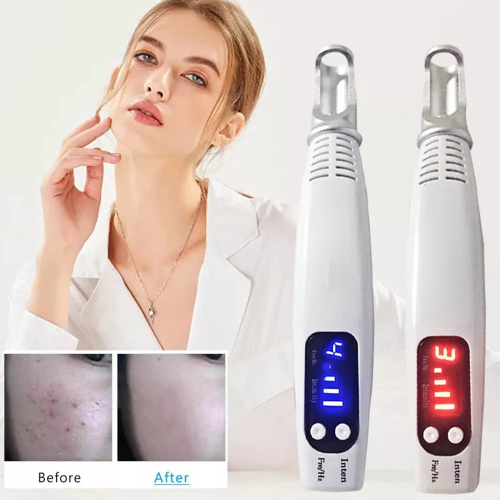 Tattoo & Blemish Removal Laser Pen – Safe & Effective Skin Care - onlinemegasale.com Tattoo & Blemish Removal Laser Pen – Safe & Effective Skin Care - onlinemegasale.com