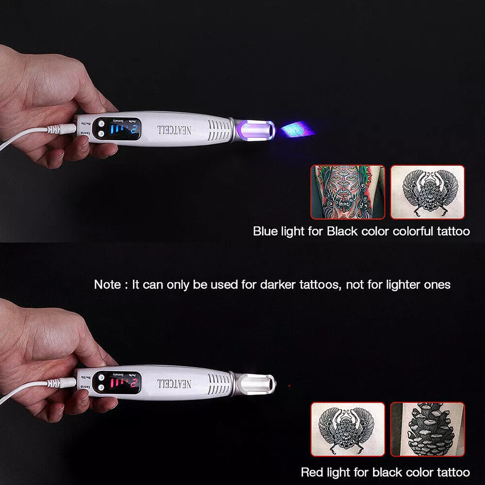 Tattoo & Blemish Removal Laser Pen – Safe & Effective Skin Care - onlinemegasale.com Tattoo & Blemish Removal Laser Pen – Safe & Effective Skin Care - onlinemegasale.com
