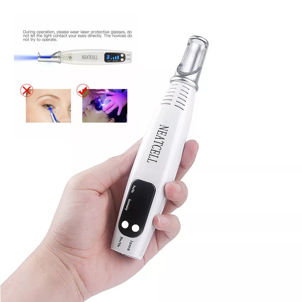 Tattoo & Blemish Removal Laser Pen – Safe & Effective Skin Care - onlinemegasale.com Tattoo & Blemish Removal Laser Pen – Safe & Effective Skin Care - onlinemegasale.com