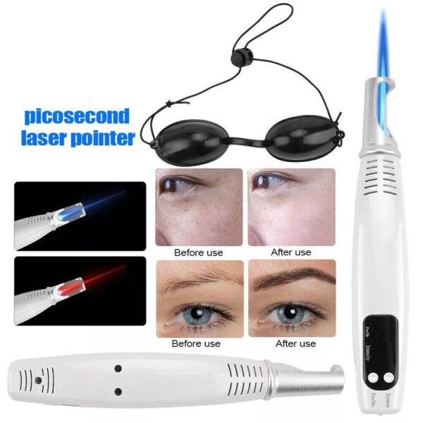 Tattoo Removal Laser Pen Dark Spot, Mole, Scar Removal Pen | Tattoo Removal Near Me