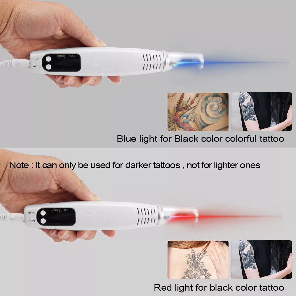 Tattoo Removal Laser Pen Dark Spot, Mole, Scar Removal Pen | Tattoo Removal Near Me - onlinemegasale.com Tattoo Removal Laser Pen Dark Spot, Mole, Scar Removal Pen | Tattoo Removal Near Me - onlinemegasale.com