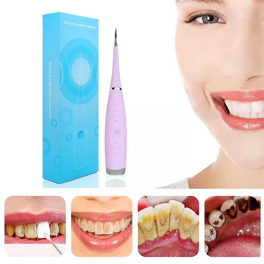 Rechargeable Ultrasonic Plaque Remover