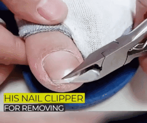 40% OFF🔥Professional Nail Clipper Kit - onlinemegasale.com