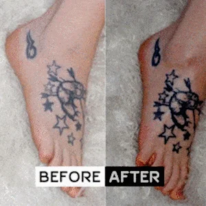 🔥BIG SALE - HALF PRICE🔥🔥Tattoo Brightening Aftercare Balm - onlinemegasale.com