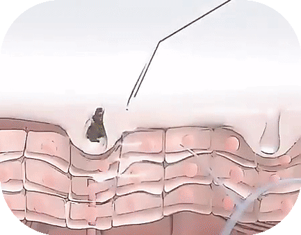 Skinessence PRO™ - Facial skincare Enhancer - by Blossomskin - onlinemegasale.com skincare face enhancer